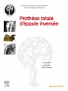 غلاف SOFCOT & Luc Favard: Prothèse totale d''épaule inversée
