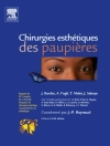Hoes van Jacques Bardot & Alain Fogli: Chirurgies esthétiques des paupières