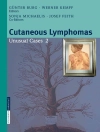 Hoes van G. Burg & W. Kempf: Cutaneous Lymphomas