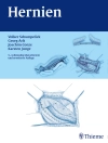 Cover of Volker Schumpelick & Georg Arlt: Hernien