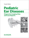 perlindungan daripada Y. Naito: Pediatric Ear Diseases