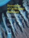 Cover of Loffler & Meyer: Stereoatlas of Ophthalmic Pathology