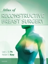 Portada de Nolan S Karp & Lee L.Q. Pu: Atlas of Reconstructive Breast Surgery - E-book