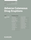 Copertina di L.E. French: Adverse Cutaneous Drug Eruptions