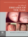 Pokrywa Phoebe Rich & Richard K. Scher: An Atlas of Diseases of the Nail