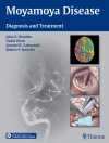 Cover of John E. Wanebo & Nadia Khan: Moyamoya Disease